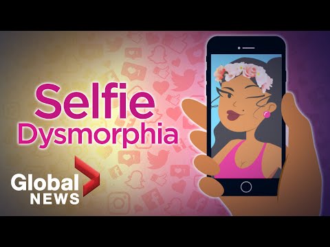 Selfie Dysmorphia: How social media filters are distorting beauty 🤳🏽